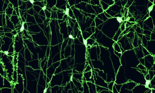 Functional Connectivity Brain Changes Involving Linkages Between Cognition and Motor Function Are Discerned in OCD Patients