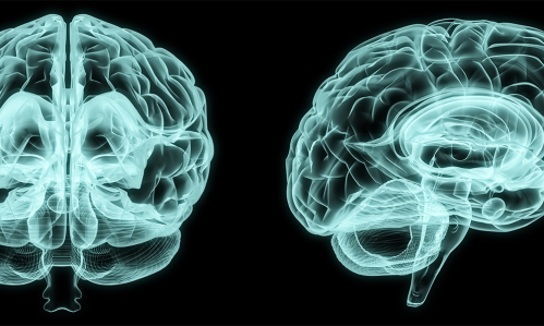 Analysis of Brain Scans Reveals Differences in Brains of Boys and Girls with Autism Spectrum Disorder